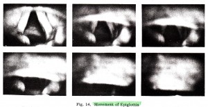 Fig. 14 Movement of Epiglottis