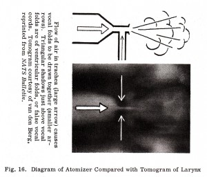 Fig. 16. Diagram of Atomizer Compared with Tomogram of Larynx
